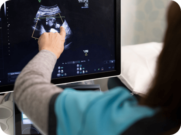 Ultrasound